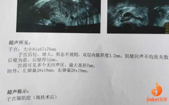 上海有哪些试管助孕公司？?,上海试管无忧助孕存在哪些问题？