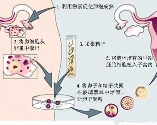 代妈做试管婴儿的全部费用大概是多少，五万够吗?