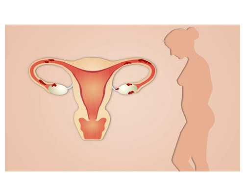 长沙代生那便宜