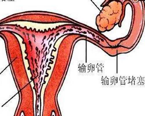 重庆正规代妈机构 2024重庆试管婴儿包生男孩医院排名 ‘彩超单子上有男女标志